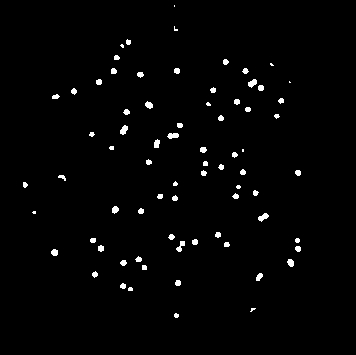 Blobs indicating bacteria