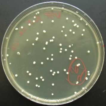 Bacteria in Petri Dish
