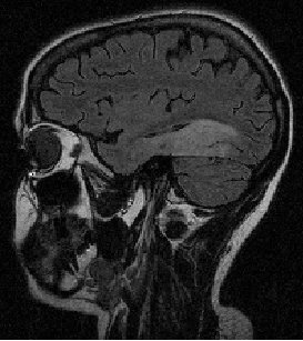 Ambiguous MRI