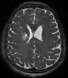Multimodal MRI