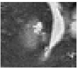 Multimodal MRI