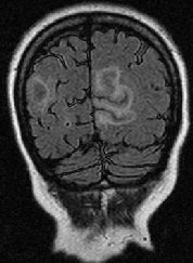 Complexly Shaped MRI