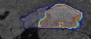 Automatic Segmented MRI