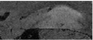 Original MRI